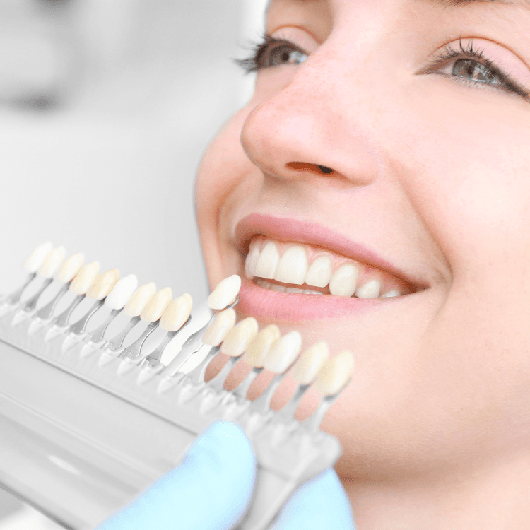 Facetas dentárias em porcelana